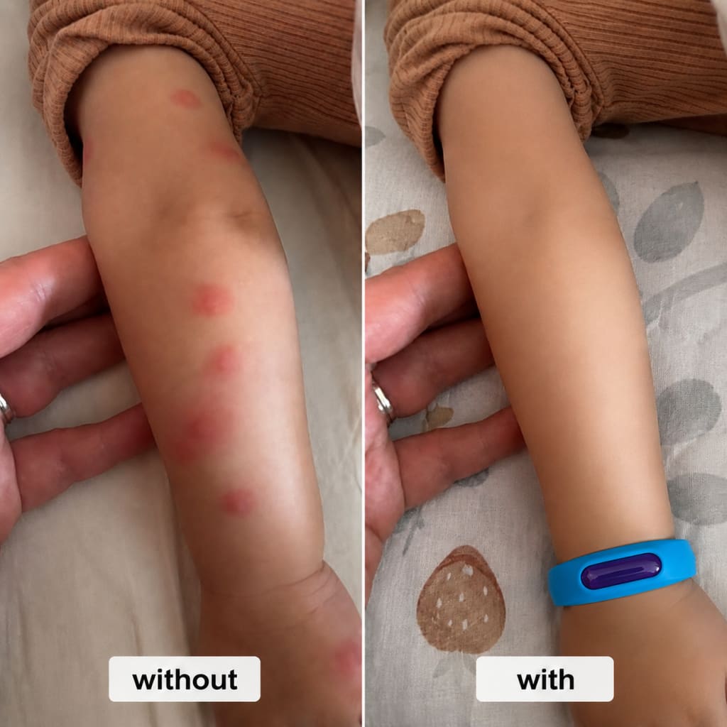Zyrex™ Mosquito Bracelet