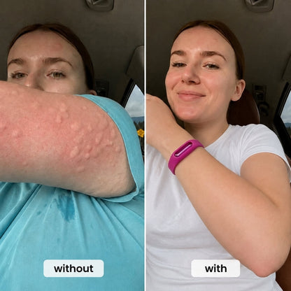 Zyrex™ Mosquito Bracelet